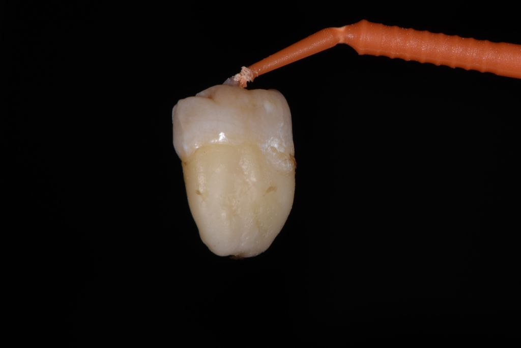 I DENTI DEL GIUDIZIO